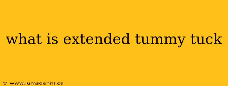 what is extended tummy tuck