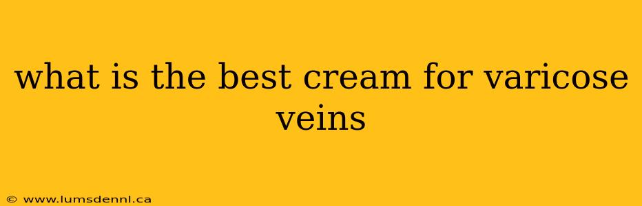 what is the best cream for varicose veins