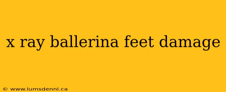 x ray ballerina feet damage
